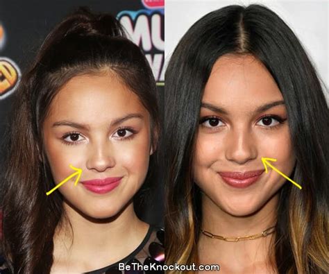 does olivia rodrigo have implants|Olivia Rodrigo, Before and After